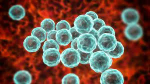 Sexually Transmitted Infection (STI) Panel