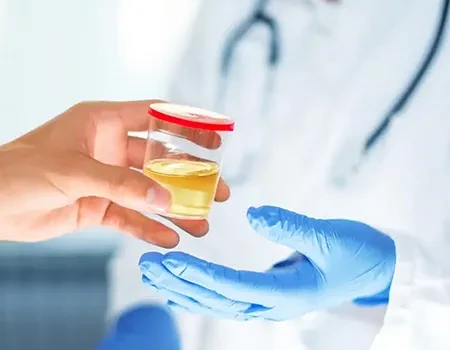 Urine Drug Testing (5 to 14 panel)