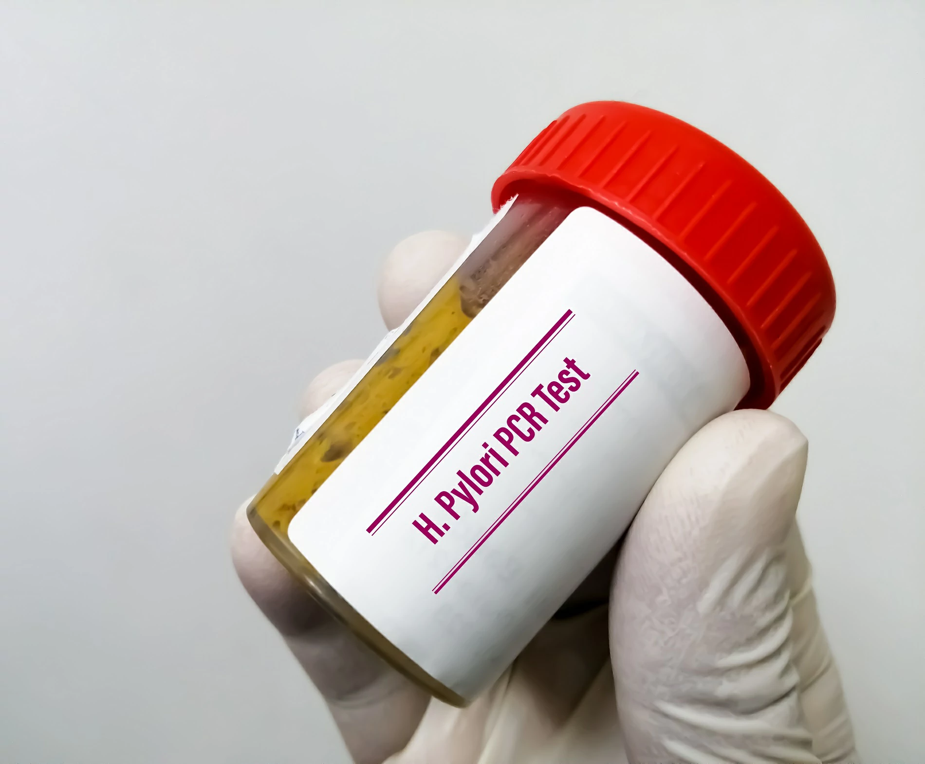 H. pylori Antigen Testing